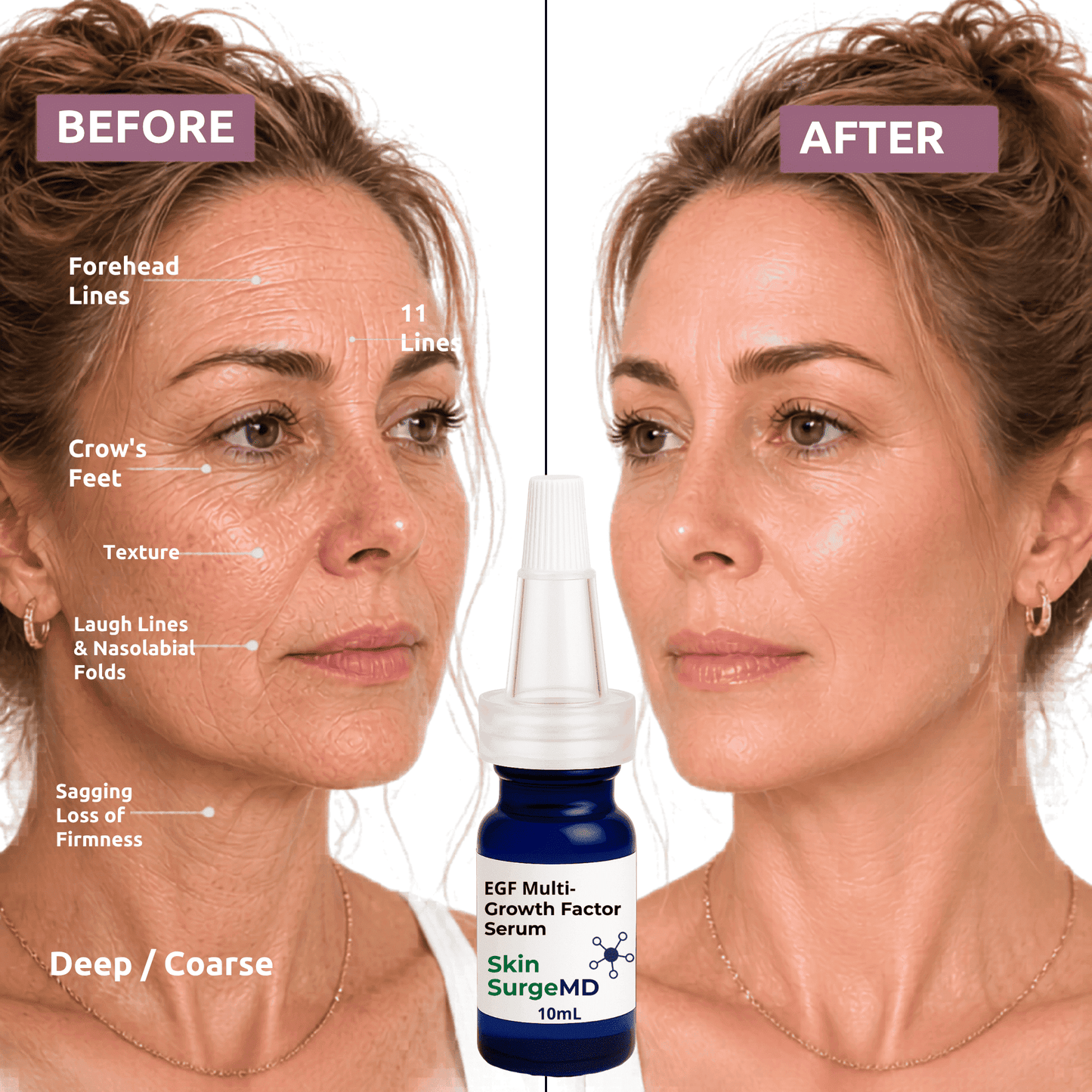 EGF Serum + bFGF + 4% Syn-Ake Cellular Repair |  Deep Wrinkle Lift Serum
