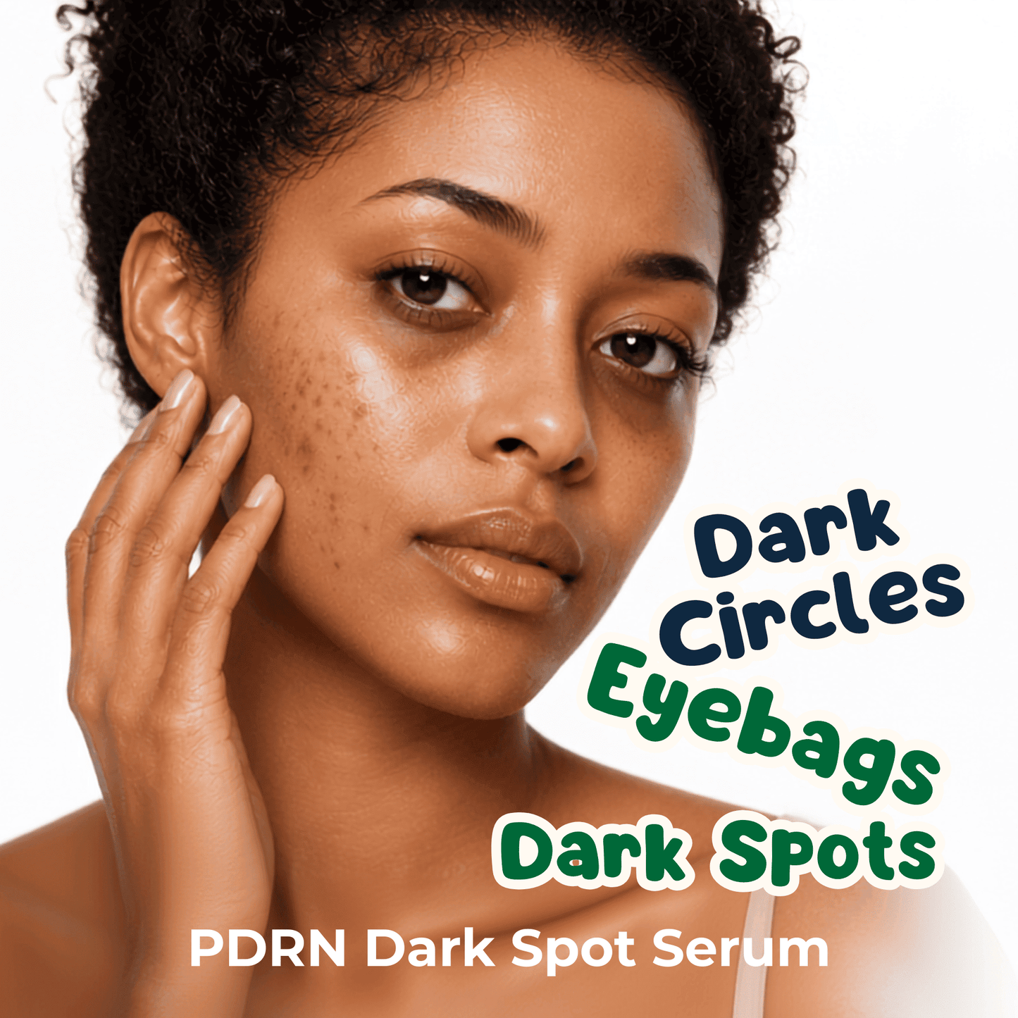 A close-up of a woman with dark circles and dark spots on her face, with text reading 'Dark Circles, Dark Eyebags, Dark Spots' and 'PDRN Dark Spot Serum' on a white background.
