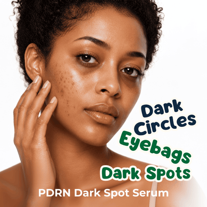 A close-up of a woman with dark circles and dark spots on her face, with text reading 'Dark Circles, Dark Eyebags, Dark Spots' and 'PDRN Dark Spot Serum' on a white background.