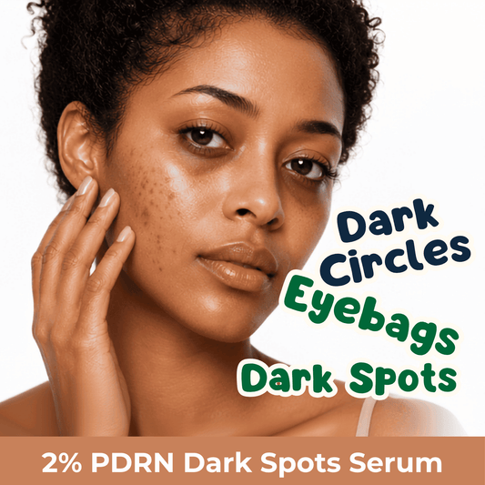 A close-up of a woman with dark circles and dark spots on her face, with text reading 'Dark Circles, Dark Eyebags, Dark Spots' and 'PDRN Dark Spot Serum' on a white background.