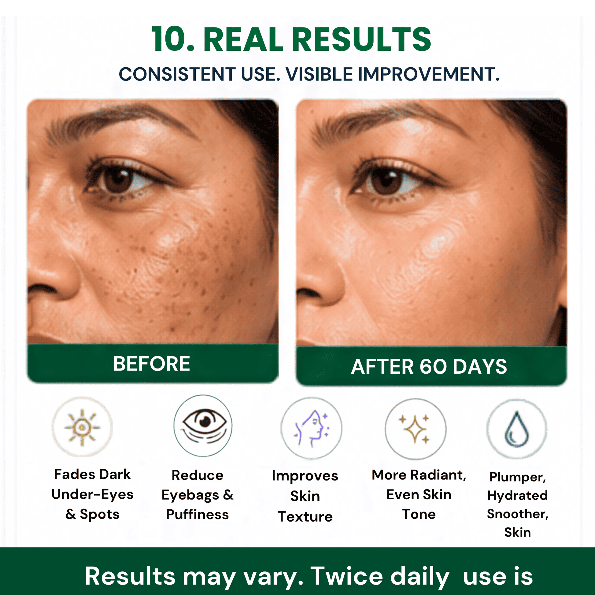A before-and-after skincare comparison graphic showing close-up views of a woman's eye and cheek with dark spots and puffiness labeled 'BEFORE' and smoother, clearer skin labeled 'AFTER 60 DAYS.' Text at the top reads Real Resulys.