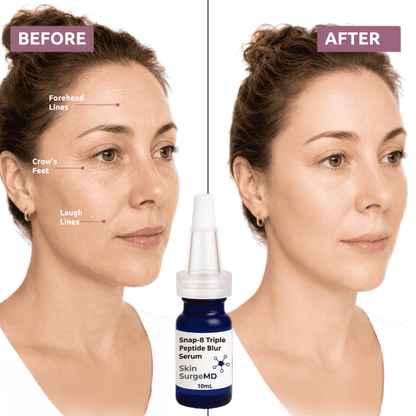 Snap-8 peptide Before and after comparison of a woman's face with crow's feet, laugh lines, and forehead wrinkles. A 10ml bottle of Snap-8 Triple Peptide Blur Serum