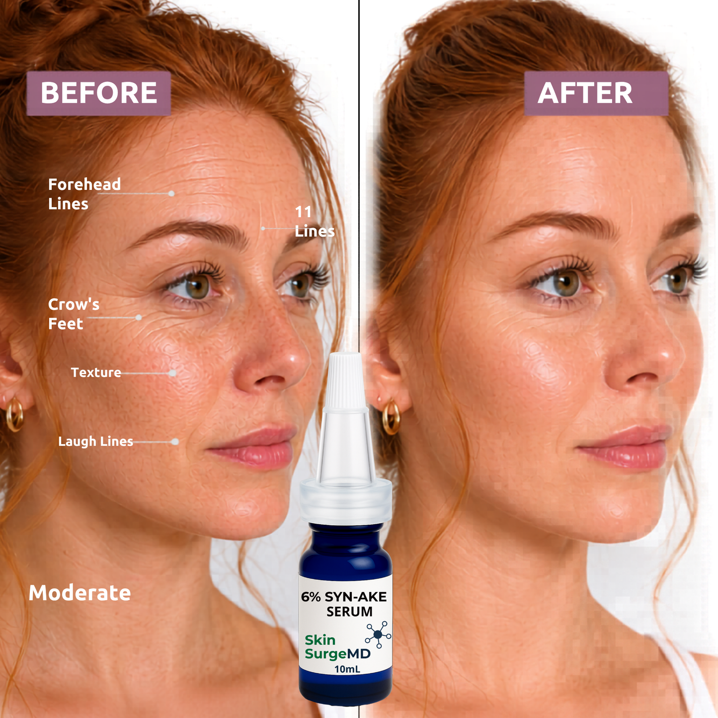 6% Syn-Ake Serum (Snake Venom Peptide) + GHK-Cu + EGF