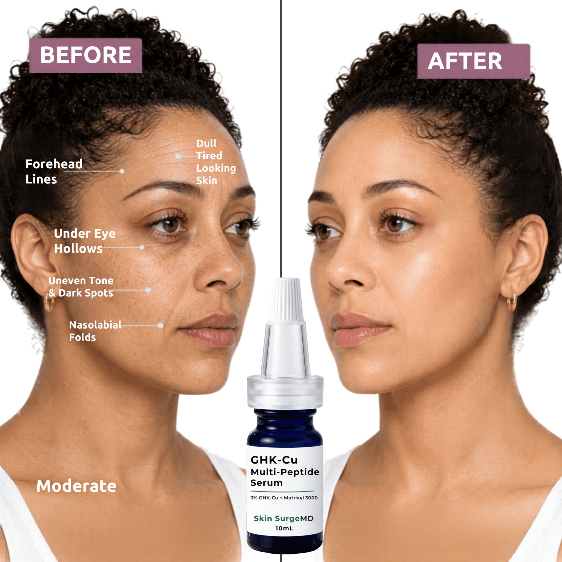 ghk cu peptides before and after 2% GHK-CU Peptide Serum | Collagen Booster Peptide B Complex Liquid Vitamins insulin SIZE:4oz. Pilot Batch