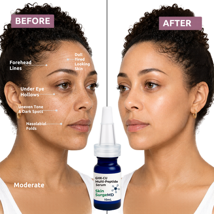 Before and after comparison of facial skin with a bottle of 2% GHKCu serum.