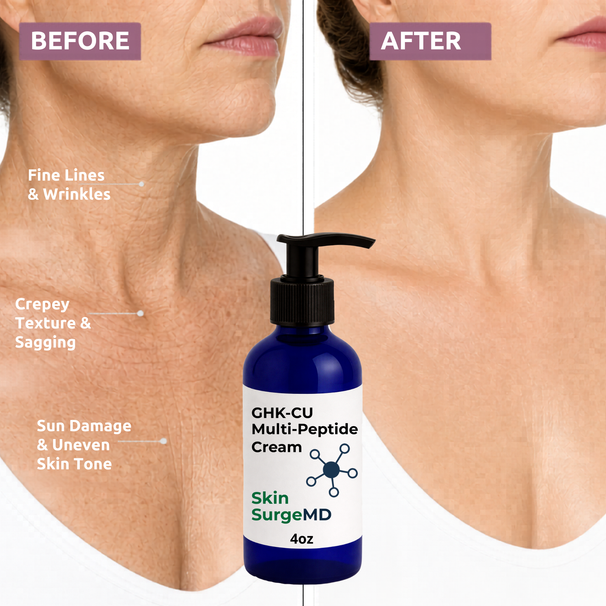 Before and after comparison of loose neck skin with a bottle of GHKCu cream