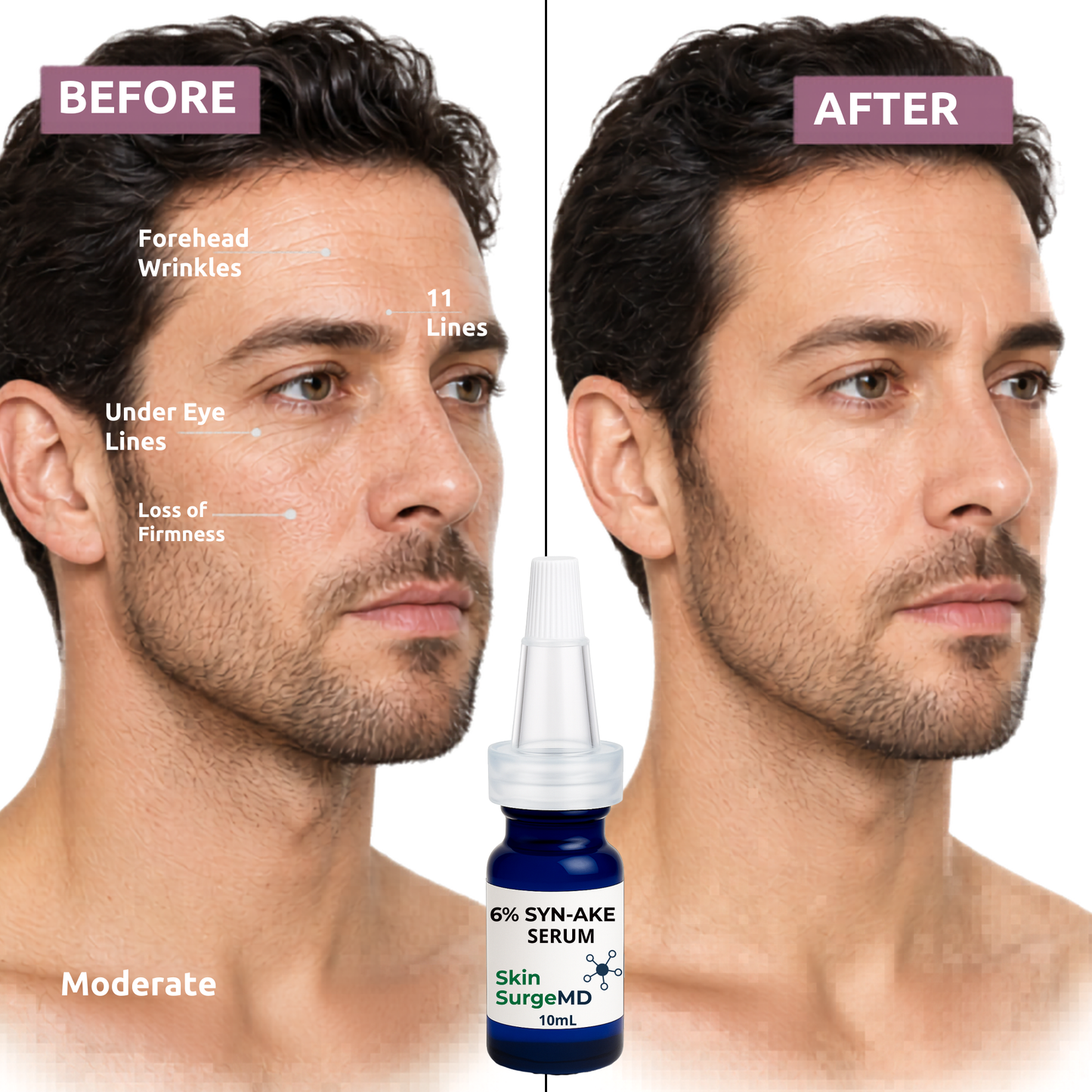 6% Syn-Ake Serum (Snake Venom Peptide) + GHK-Cu + EGF