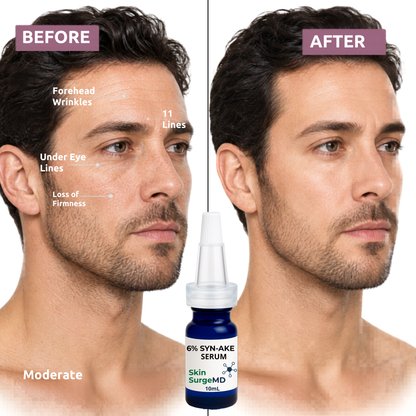 6% Syn-Ake Serum (Snake Venom Peptide) + GHK-Cu + EGF