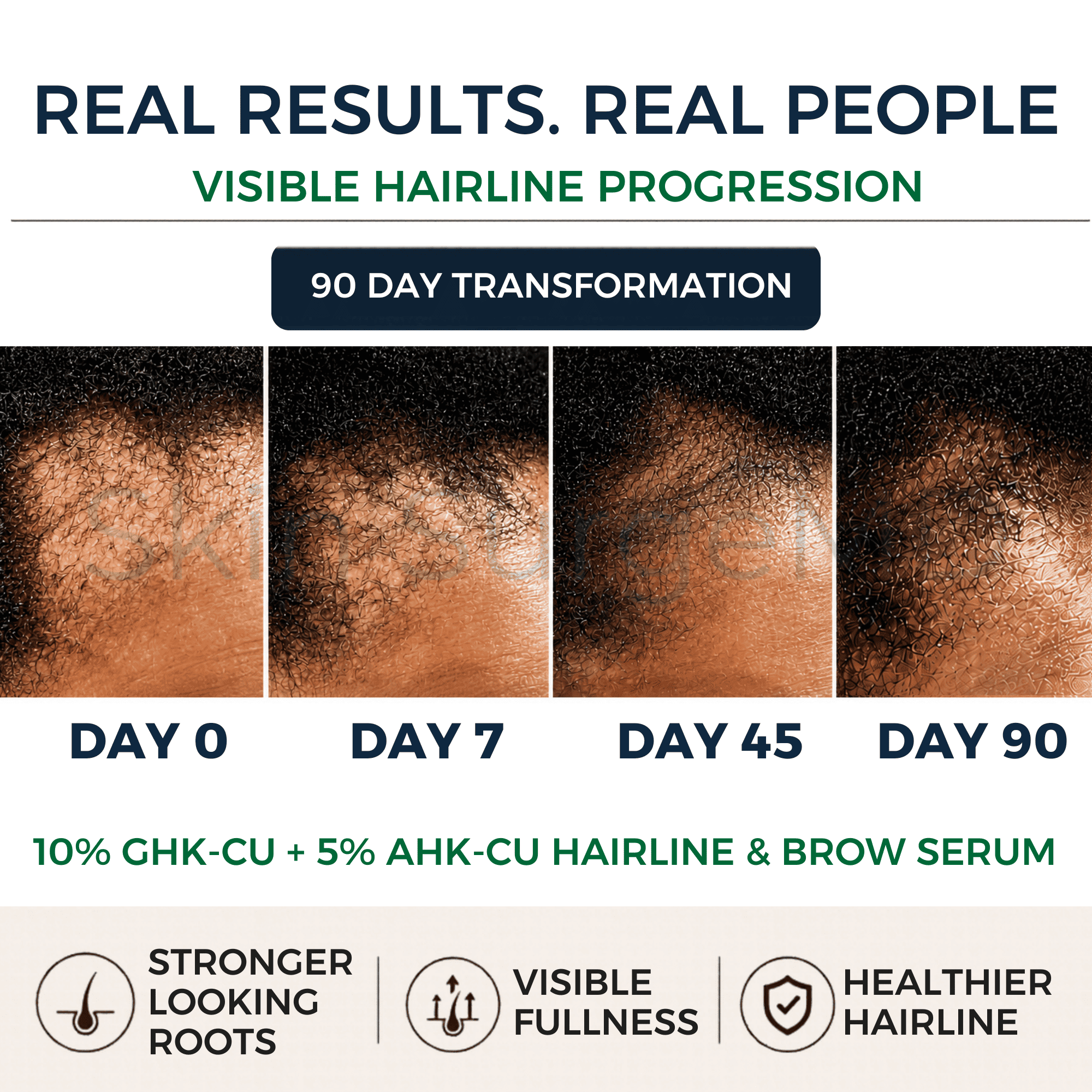 GHK + AHK Hairline & Brow Serum application video — peptide hair growth serum by Skin SurgeMD
