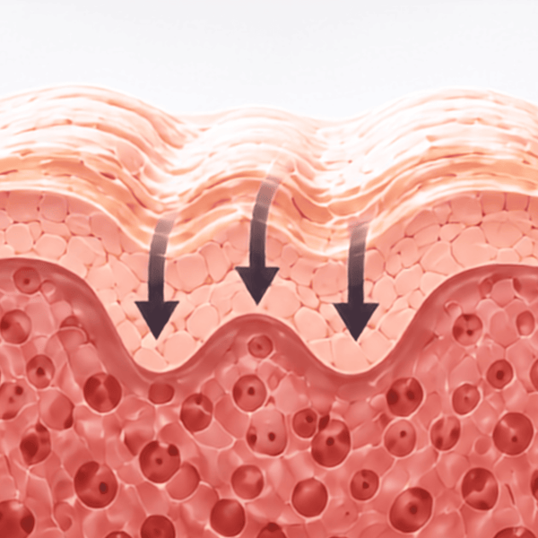 A cross-sectional illustration of skin layers with three downward arrows indicating pressure or texture effect, on a white background represent Snap-8.