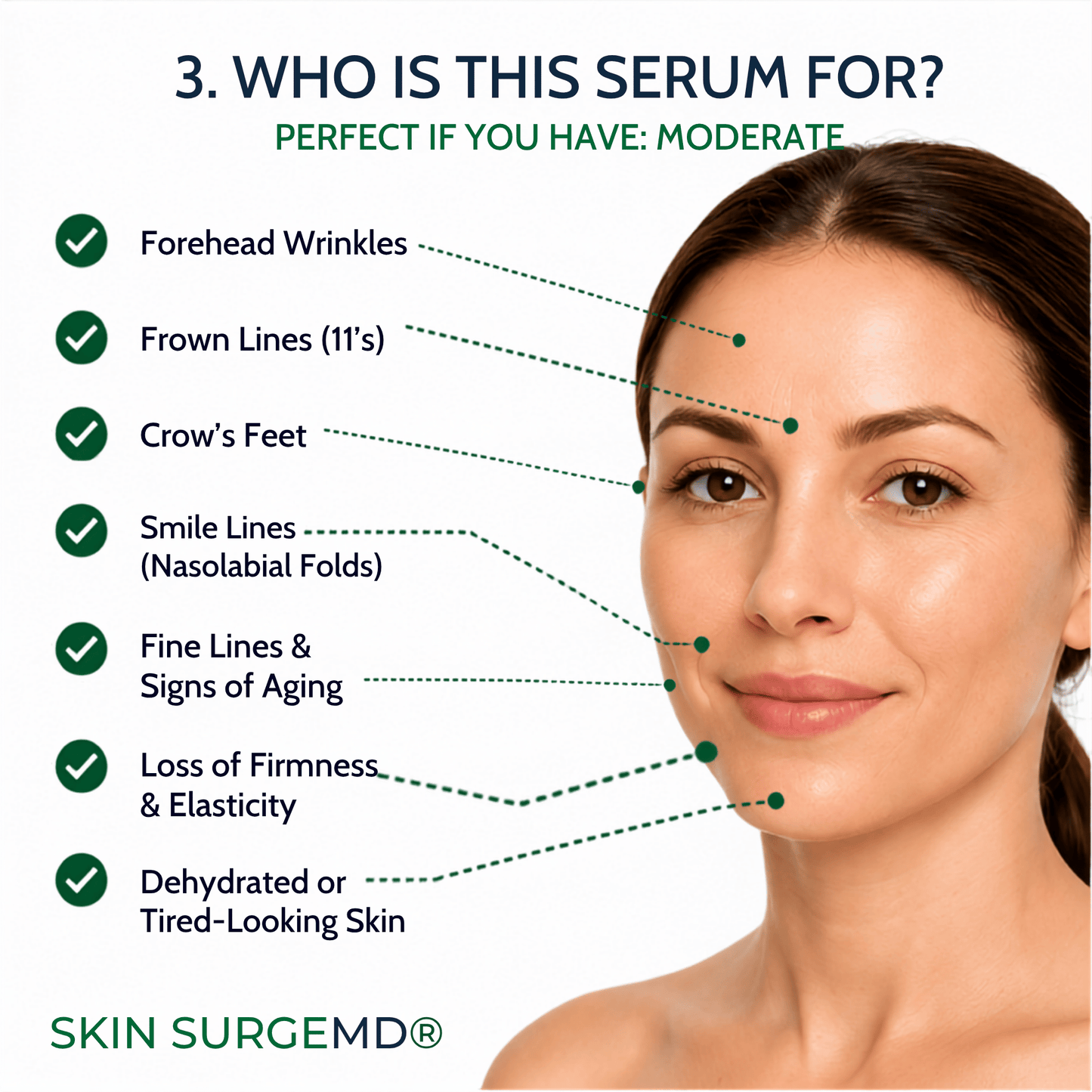 An informational graphic for Skin SurgMD 10% Syn-Ake serum, featuring a close-up of a woman's face with text and dotted lines pointing out skin aging concerns like forehead wrinkles, crow's feet, smile lines, and fine lines, on a white background.