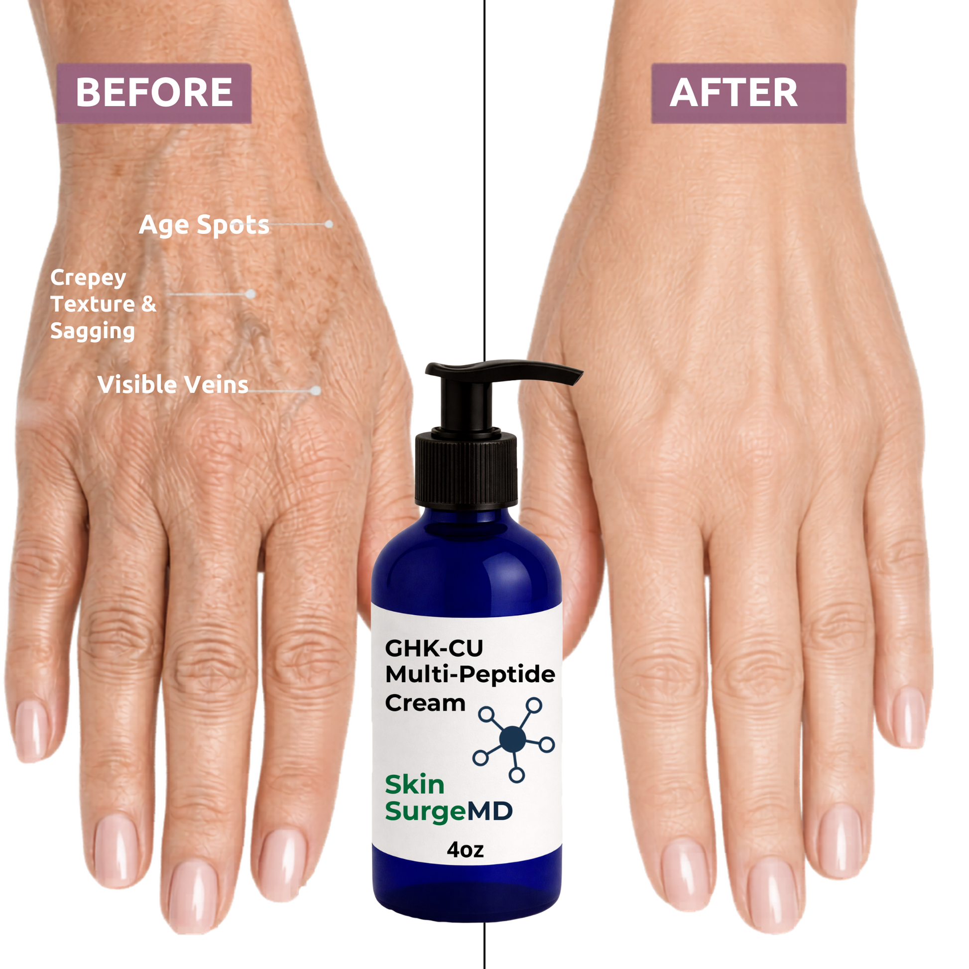 Before and after comparison of wrinkly hands with a bottle of GHKCu cream